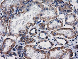 CTNNB1 / Beta Catenin Antibody - IHC of paraffin-embedded Human Kidney tissue using anti-CTNNB1 mouse monoclonal antibody.