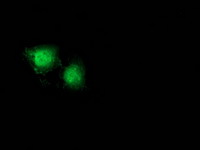 CTNNB1 / Beta Catenin Antibody - Anti-CTNNB1 mouse monoclonal antibody immunofluorescent staining of COS7 cells transiently transfected by pCMV6-ENTRY CTNNB1.