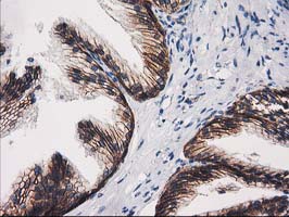 CTNNB1 / Beta Catenin Antibody - IHC of paraffin-embedded Human prostate tissue using anti-CTNNB1 mouse monoclonal antibody.