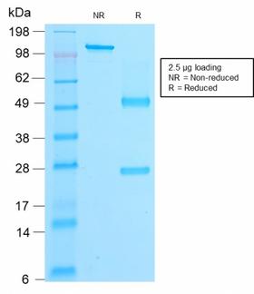 CTNNB1 / Beta Catenin Antibody - SDS-PAGE Analysis Purified Beta-Catenin Mouse Recombinant Monoclonal Ab (rCTNNB1/2173). Confirmation of Purity and Integrity of Antibody.
