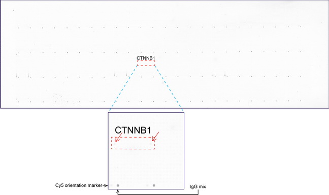 CTNNB1 / Beta Catenin Antibody - OriGene overexpression protein microarray chip was immunostained with UltraMAB anti-beta-catenin mouse monoclonal antibody. (Clone UMAB14). The positive reactive proteins are highlighted with two red arrows in the enlarged subarray. All the positive controls spotted in this subarray are also labeled for clarification. These data show that UltraMAB anti-beta-catenin. (Clone UMAB14) very specifically recognizes beta-catenin antigen on OriGene protein microarray chip.