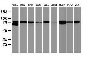 CTNNB1 / Beta Catenin Antibody - Western blot analysis of extracts. (35ug) from 9 different cell lines by using anti-CTNNB1 monoclonal antibody. (Clone UMAB14).