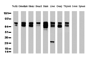 CTNNB1 / Beta Catenin Antibody - Western Blot analysis of 10 different human tissue lysates. (10ug) by using Anti-ß-Catenin monoclonal antibody. (Clone UMAB14, 1:500)