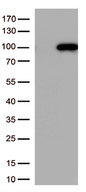 CTNNB1 / Beta Catenin Antibody - HEK293T cells were transfected with the pCMV6-ENTRY control. (Left lane) or pCMV6-ENTRY CTNNB1. (Right lane) cDNA for 48 hrs and lysed. Equivalent amounts of cell lysates. (5 ug per lane) were separated by SDS-PAGE and immunoblotted with anti-CTNNB1. (1:500)