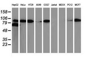 CTNNB1 / Beta Catenin Antibody - Western blot analysis of extracts. (35ug) from 9 different cell lines by using anti-CTNNB1 monoclonal antibody.