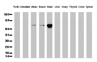 CTNNB1 / Beta Catenin Antibody - Western Blot analysis of 10 different human tissue lysates. (10ug) by using Anti-ß-Catenin monoclonal antibody. (Clone UMAB15, 1:500)