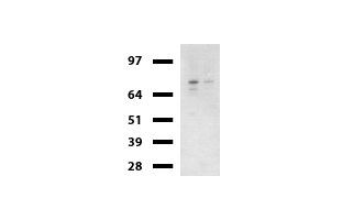 CTNNB1 / Beta Catenin Antibody - Western blot of mouse tissue lysates. (20ug) from Uterus and Ovary. Primary antibody diluation: 1:500. Secondary antibody dilution: Mouse TrueBlot® Ultra. (1:1000).