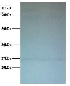 CTNNB1 / Beta Catenin Antibody - Western blot of Catenin beta-1 antibody at 2 ug/ml. Lane 1: EC109 whole cell lysate. Lane 2: 293T whole cell lysate. Secondary: Goat polyclonal to Rabbit IgG at 1:15000 dilution. Predicted band size: 86 kDa. Observed band size: 86 kDa Additional bands at: 27 kDa. We are unsure as to the identity of this extra band.  This image was taken for the unconjugated form of this product. Other forms have not been tested.