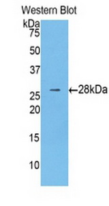 CTNNB1 / Beta Catenin Antibody - Western Blot; Sample: Recombinant CTNNb1, Human.