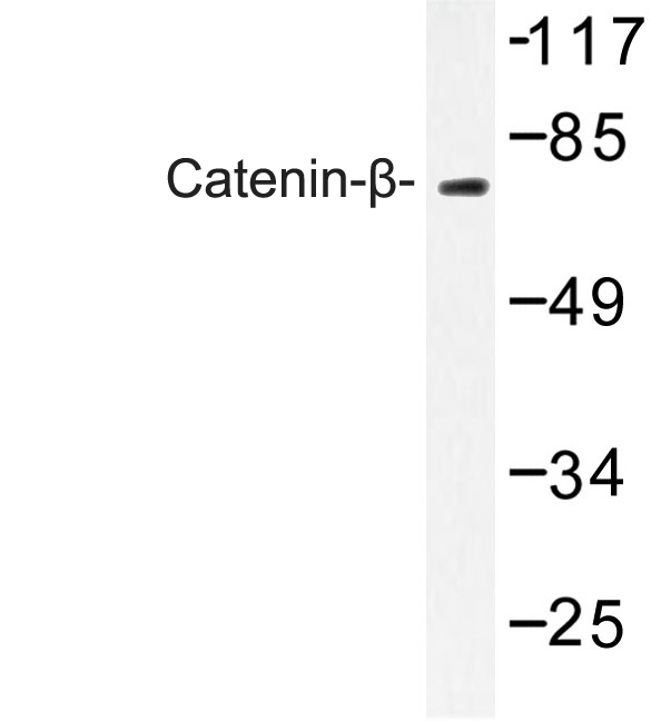 CTNNB1 / Beta Catenin Antibody - Western blot of Catenin- (G650) pAb in extracts from rat brain cells.
