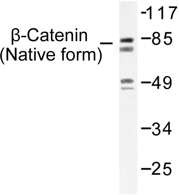 CTNNB1 / Beta Catenin Antibody - Western blot of Catenin- (I35) pAb in extracts from SW626 cells.