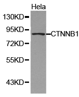 CTNNB1 / Beta Catenin Antibody - Western blot of extracts of HeLa cell lines, using CTNNB1 antibody.