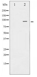 CTNNB1 / Beta Catenin Antibody - Western blot of Catenin- beta expression in 293 whole cell lysates,The lane on the left is treated with the antigen-specific peptide.