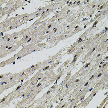 CTNNB1 / Beta Catenin Antibody - Immunohistochemistry of paraffin-embedded rat heart using CTNNB1 antibody at dilution of 1:100 (40x lens).