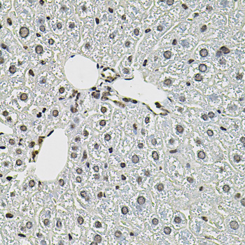 CTNNB1 / Beta Catenin Antibody - Immunohistochemistry of paraffin-embedded mouse liver using CTNNB1 antibody at dilution of 1:100 (40x lens).