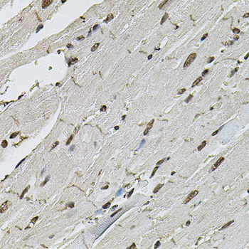 CTNNB1 / Beta Catenin Antibody - Immunohistochemistry of paraffin-embedded mouse heart using CTNNB1 antibody at dilution of 1:100 (40x lens).