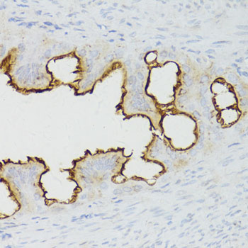 CTNNB1 / Beta Catenin Antibody - Immunohistochemistry of paraffin-embedded rat fallopian tube using CTNNB1 antibody at dilution of 1:150 (40x lens).