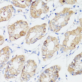 CTNNB1 / Beta Catenin Antibody - Immunohistochemistry of paraffin-embedded human stomach using CTNNB1 antibody at dilution of 1:150 (40x lens).