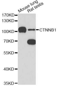 CTNNB1 / Beta Catenin Antibody - Western blot analysis of extracts of various cell lines, using CTNNB1 antibody at 1:1000 dilution. The secondary antibody used was an HRP Goat Anti-Rabbit IgG (H+L) at 1:10000 dilution. Lysates were loaded 25ug per lane and 3% nonfat dry milk in TBST was used for blocking. An ECL Kit was used for detection and the exposure time was 90s.