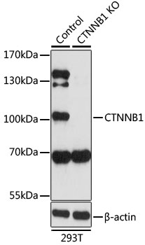 CTNNB1 / Beta Catenin Antibody - Western blot analysis of extracts from normal (control) and CTNNB1 knockout (KO) 293T cells, using CTNNB1 antibody at 1:1000 dilution. The secondary antibody used was an HRP Goat Anti-Rabbit IgG (H+L) at 1:10000 dilution. Lysates were loaded 25ug per lane and 3% nonfat dry milk in TBST was used for blocking. An ECL Kit was used for detection and the exposure time was 90s.