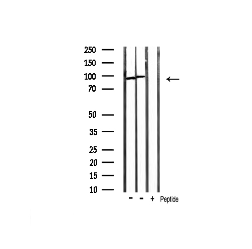 CTNNB1 / Beta Catenin Antibody - Western blot analysis of extracts of various sample using Catenin-Beta antibody.