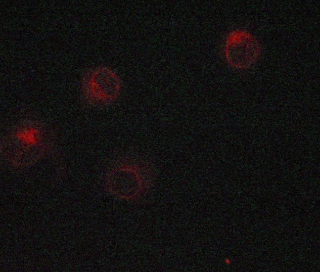 CTNNB1 / Beta Catenin Antibody - Staining MCF-7 cells by IF/ICC. The samples were fixed with PFA and permeabilized in 0.1% saponin prior to blocking in 10% serum for 45 min at 37°C. The primary antibody was diluted 1/400 and incubated with the sample for 1 hour at 37°C. A Alexa Fluor® 594 conjugated goat polyclonal to rabbit IgG (H+L), diluted 1/600 was used as secondary antibody.