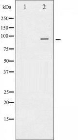 CTNNB1 / Beta Catenin Antibody - Western blot analysis of Catenin-Beta expression in 293 whole cells lysates. The lane on the left is treated with the antigen-specific peptide.