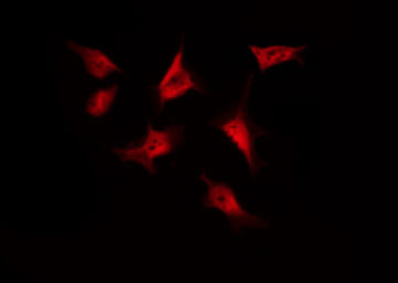 CTNNB1 / Beta Catenin Antibody - Staining SW626 cells by IF/ICC. The samples were fixed with PFA and permeabilized in 0.1% Triton X-100, then blocked in 10% serum for 45 min at 25°C. The primary antibody was diluted at 1:200 and incubated with the sample for 1 hour at 37°C. An Alexa Fluor 594 conjugated goat anti-rabbit IgG (H+L) Ab, diluted at 1/600, was used as the secondary antibody.