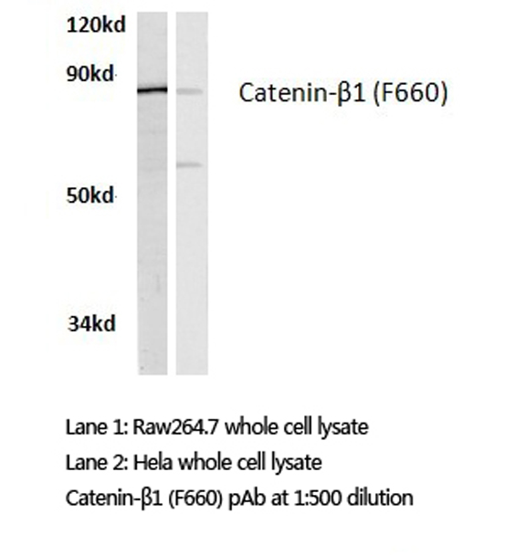 CTNNB1 / Beta Catenin Antibody - Western blot of Catenin-1 (F660) pAb in extracts from HeLa cells and raw264.7 cells.
