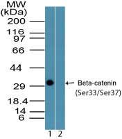 CTNNB1 / Beta Catenin Antibody - Western blot of Beta-catenin (Ser33/Ser37) in recombinant fusion protein containing 1) phosphorylated serine residues at positions 33 and 37 and 2) unphosphorylated serine residues at positions 33 and 37, using beta catenin phospho antibody at 0.25 ug/ml. Goat anti-rabbit Ig HRP secondary antibody, and PicoTect ECL substrate solution, were used for this test.