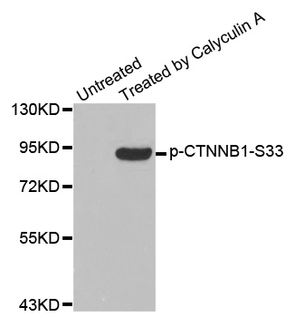 CTNNB1 / Beta Catenin Antibody - Western blot analysis of extracts from MCF-7 cells.