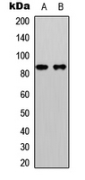 CTNNB1 / Beta Catenin Antibody - Western blot analysis of Beta-catenin (pS33) expression in HeLa (A); HepG2 (B) whole cell lysates.