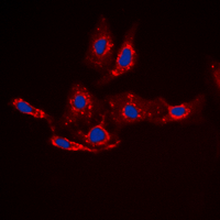 CTNNB1 / Beta Catenin Antibody - Immunofluorescent analysis of Beta-catenin (pS33) staining in HepG2 cells. Formalin-fixed cells were permeabilized with 0.1% Triton X-100 in TBS for 5-10 minutes and blocked with 3% BSA-PBS for 30 minutes at room temperature. Cells were probed with the primary antibody in 3% BSA-PBS and incubated overnight at 4 deg C in a humidified chamber. Cells were washed with PBST and incubated with a DyLight 594-conjugated secondary antibody (red) in PBS at room temperature in the dark. DAPI was used to stain the cell nuclei (blue).