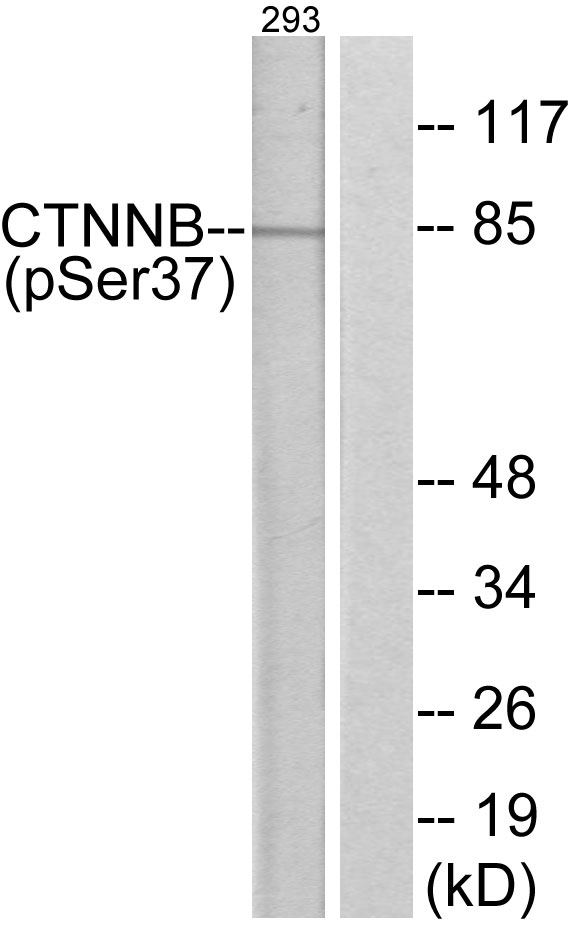 CTNNB1 / Beta Catenin Antibody - Western blot analysis of lysates from 293 cells, using Catenin-beta (Phospho-Ser37) Antibody. The lane on the right is blocked with the phospho peptide.