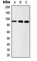 CTNNB1 / Beta Catenin Antibody - Western blot analysis of Beta-catenin (pS37) expression in U2OS (A); HeLa (B); NIH3T3 (C) whole cell lysates.