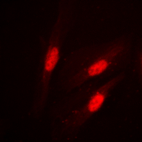 CTNNB1 / Beta Catenin Antibody - Immunofluorescent analysis of Beta-catenin (pS37) staining in HeLa cells. Formalin-fixed cells were permeabilized with 0.1% Triton X-100 in TBS for 5-10 minutes and blocked with 3% BSA-PBS for 30 minutes at room temperature. Cells were probed with the primary antibody in 3% BSA-PBS and incubated overnight at 4 C in a humidified chamber. Cells were washed with PBST and incubated with a DyLight 594-conjugated secondary antibody (red) in PBS at room temperature in the dark. DAPI was used to stain the cell nuclei (blue).