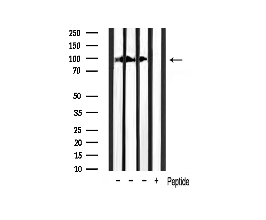 CTNNB1 / Beta Catenin Antibody - Western blot analysis of extracts of various tissue sample using Phospho-Catenin-Beta (Ser37) antibody.