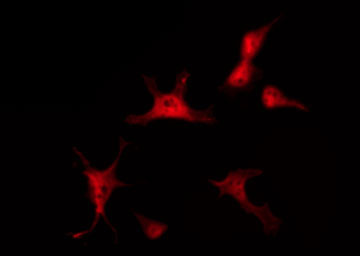 CTNNB1 / Beta Catenin Antibody - Staining SW626 cells by IF/ICC. The samples were fixed with PFA and permeabilized in 0.1% Triton X-100, then blocked in 10% serum for 45 min at 25°C. The primary antibody was diluted at 1:200 and incubated with the sample for 1 hour at 37°C. An Alexa Fluor 594 conjugated goat anti-rabbit IgG (H+L) Ab, diluted at 1/600, was used as the secondary antibody.