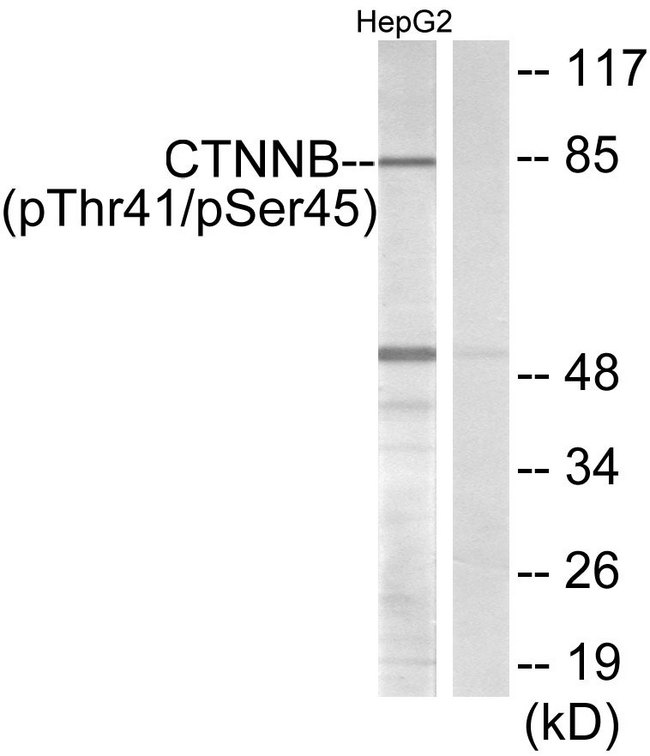 CTNNB1 / Beta Catenin Antibody - Western blot analysis of lysates from HepG2 cells, using Catenin-beta (Phospho-Thr41/Ser45) Antibody. The lane on the right is blocked with the phospho peptide.