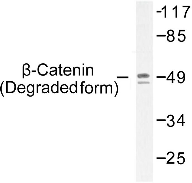CTNNB1 / Beta Catenin Antibody - Western blot of p-Catenin- (T41+S45) pAb in extracts from sw626 cells.