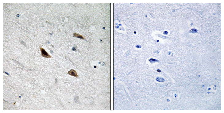 CTNNB1 / Beta Catenin Antibody - Immunohistochemistry analysis of paraffin-embedded human brain, using Catenin-beta (Phospho-Tyr489) Antibody. The picture on the right is blocked with the phospho peptide.