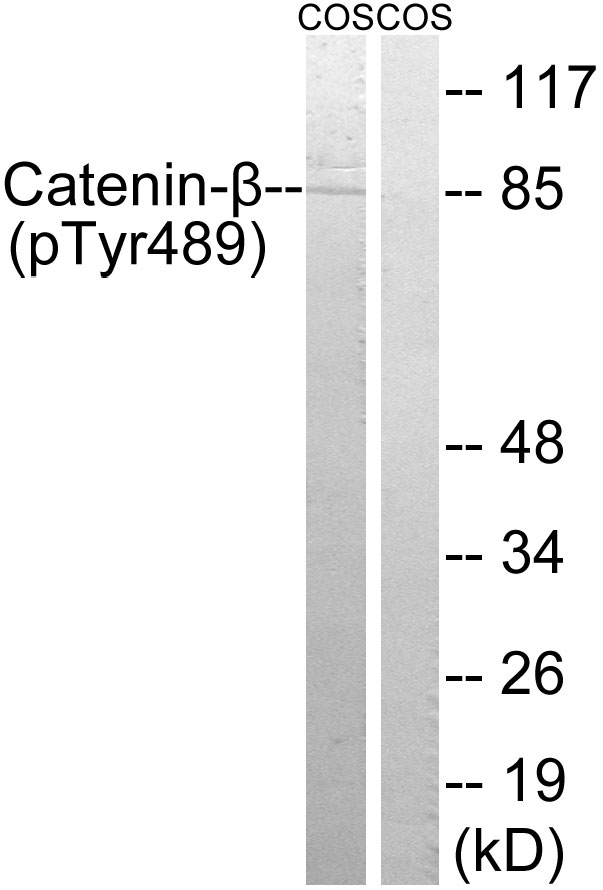 CTNNB1 / Beta Catenin Antibody - Western blot analysis of lysates from COS7 cells treated with UV 15', using Catenin-beta (Phospho-Tyr489) Antibody. The lane on the right is blocked with the phospho peptide.