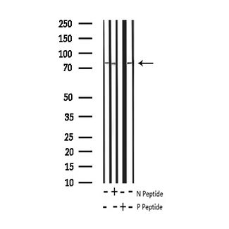 CTNNB1 / Beta Catenin Antibody - Western blot analysis of Phospho-Catenin beta (Tyr489)expression in various lysates