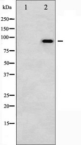 CTNNB1 / Beta Catenin Antibody - Western blot analysis of Catenin-beta phosphorylation expression in UV treated COS7 whole cells lysates. The lane on the left is treated with the antigen-specific peptide.