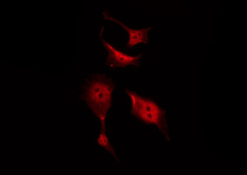 CTNNB1 / Beta Catenin Antibody - Staining SW626 cells by IF/ICC. The samples were fixed with PFA and permeabilized in 0.1% Triton X-100, then blocked in 10% serum for 45 min at 25°C. The primary antibody was diluted at 1:200 and incubated with the sample for 1 hour at 37°C. An Alexa Fluor 594 conjugated goat anti-rabbit IgG (H+L) Ab, diluted at 1/600, was used as the secondary antibody.