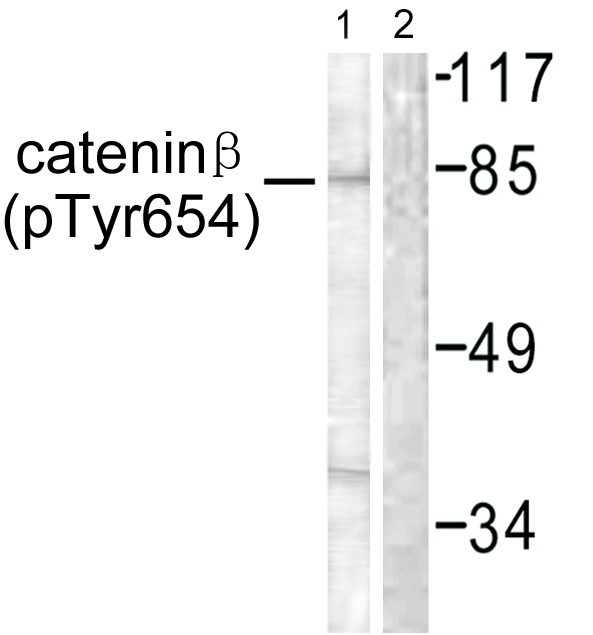 CTNNB1 / Beta Catenin Antibody - Western blot analysis of lysates from 293 cells, using Catenin-beta (Phospho-Tyr654) Antibody. The lane on the right is blocked with the phospho peptide.