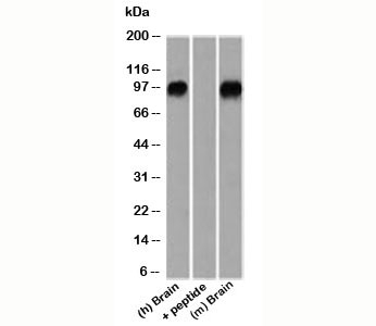 CTNNB1 / Beta Catenin Antibody - Western blot testing of human and mouse samples using beta-Catenin antibody.  This image was taken for the unmodified form of this product. Other forms have not been tested.