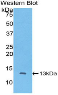 CTNNBIP1 / ICAT Antibody - Western blot of recombinant CTNNBIP1 / ICAT.  This image was taken for the unconjugated form of this product. Other forms have not been tested.