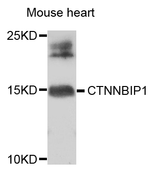 CTNNBIP1 / ICAT Antibody - Western blot analysis of extracts of mouse heart.