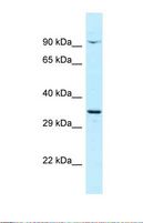 CTNNBL1 / NAP Antibody - Western blot of Human OVCAR-3 . CTNNBL1 antibody dilution 1.0 ug/ml.  This image was taken for the unconjugated form of this product. Other forms have not been tested.